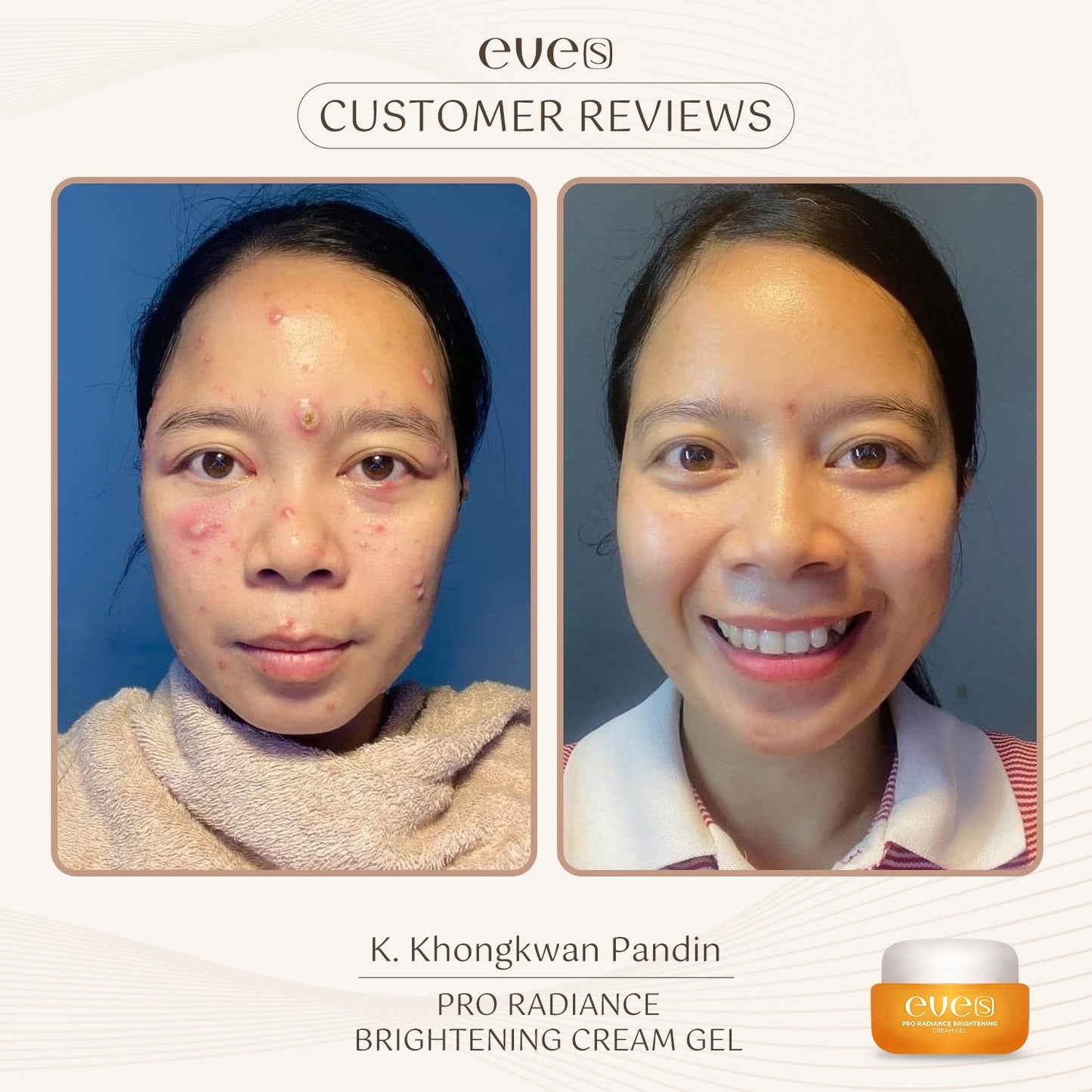 EVE’S Pro Radiance Brightening Cream Gel