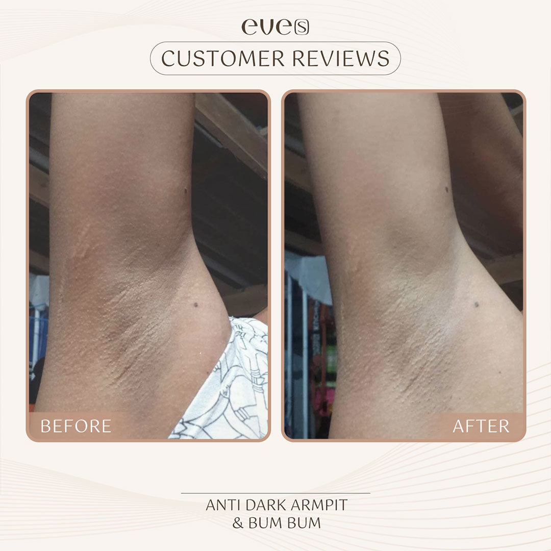 EVE’S Anti Dark Armpit & Bum Bum