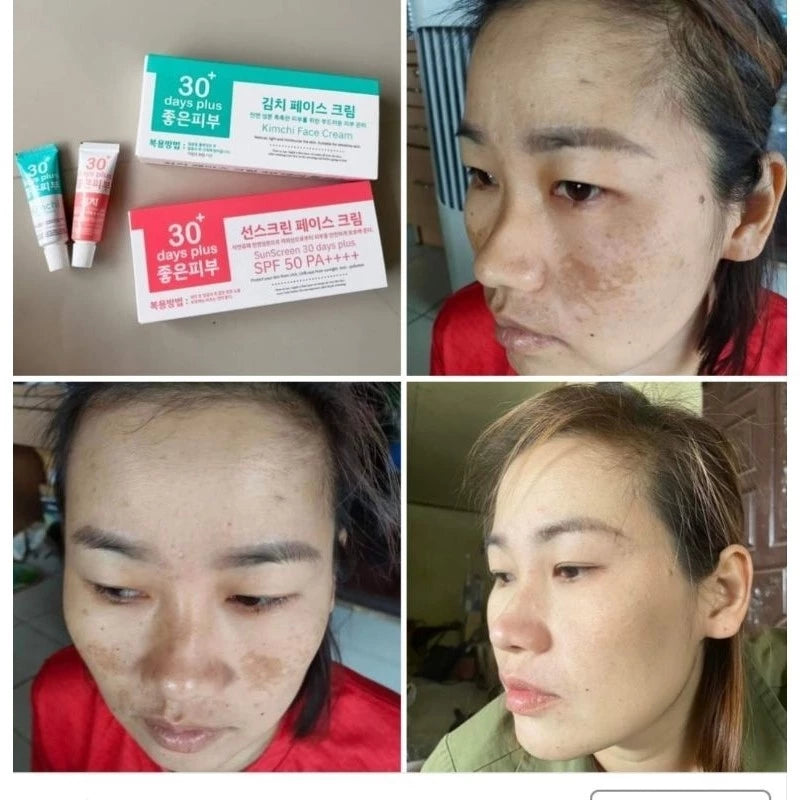 Kimchi Sun Screen กิมจิ กันแดด SPF 50 PA+++