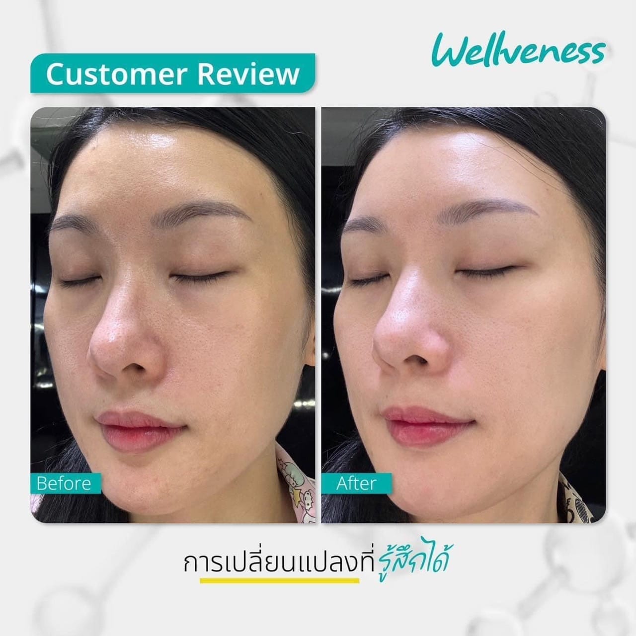 เซราไบรท์ CUCUMIS CERABRIGHT BARRIER SESUM IN CREAM คูคูมิส เซราไบร์ท แบริเอร์ เซรั่ม อิน ครีม