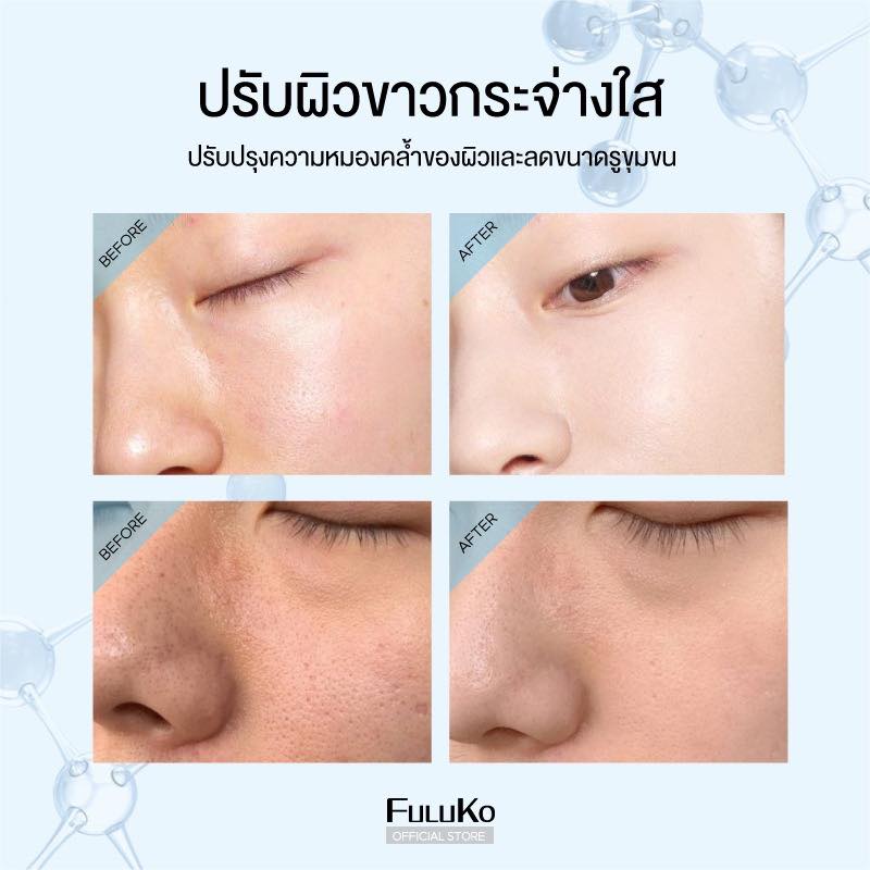 FULUKO Nicotinamide Brighten Me. Clay Mask