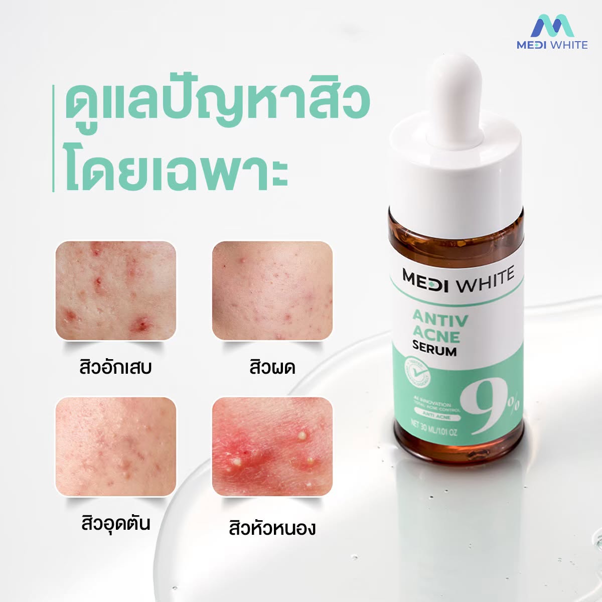 ANTIV ACNE SERUM
