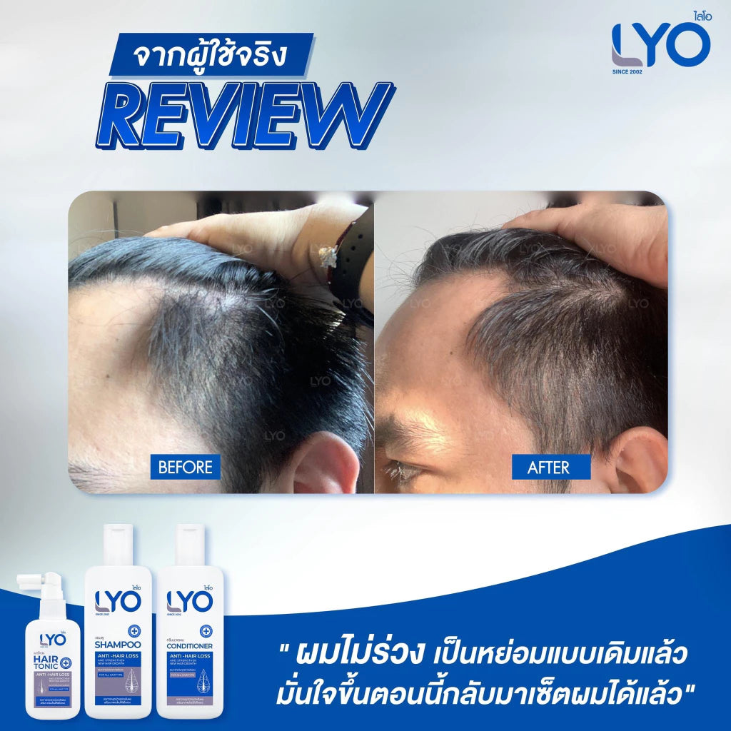 LYO Hair Tonic 30 ml.