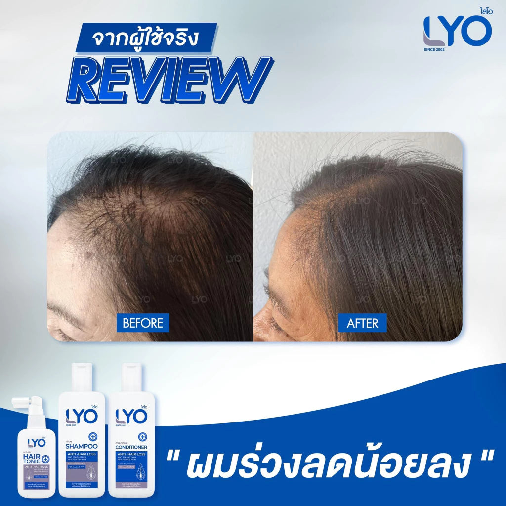 LYO Hair Tonic 30 ml.