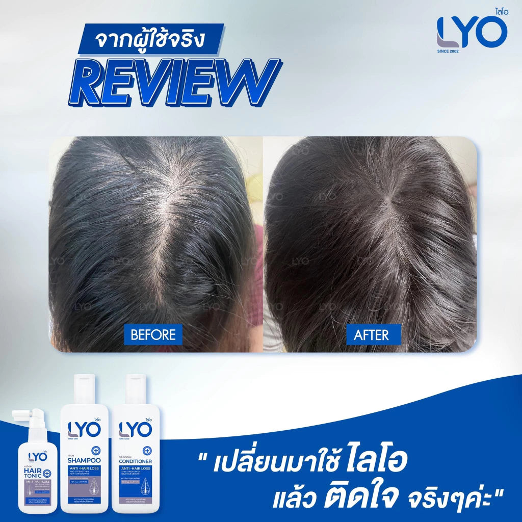 LYO Hair Tonic 30 ml.