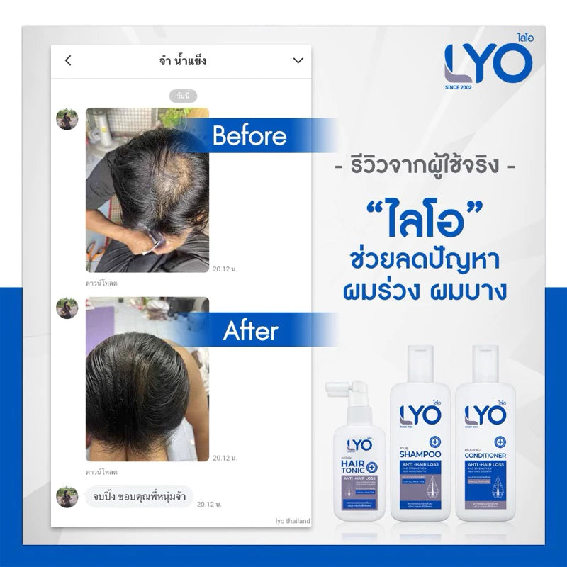 LYO SHAMPOO ไลโอ แชมพู