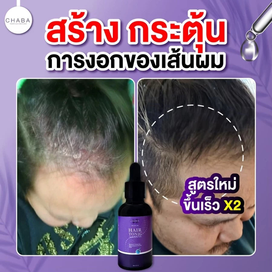 HAIR TONIC SERUM CHABA แฮร์โทนิคชบา เซรั่มผม & คิ้ว