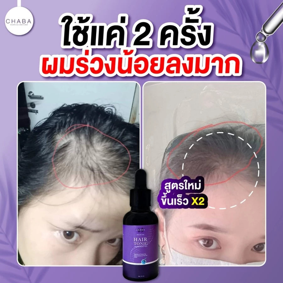 HAIR TONIC SERUM CHABA แฮร์โทนิคชบา เซรั่มผม & คิ้ว